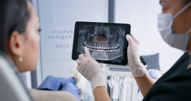 Licensed Dental Implants service in Pine Brook, NJ - Smile Center Dentistry